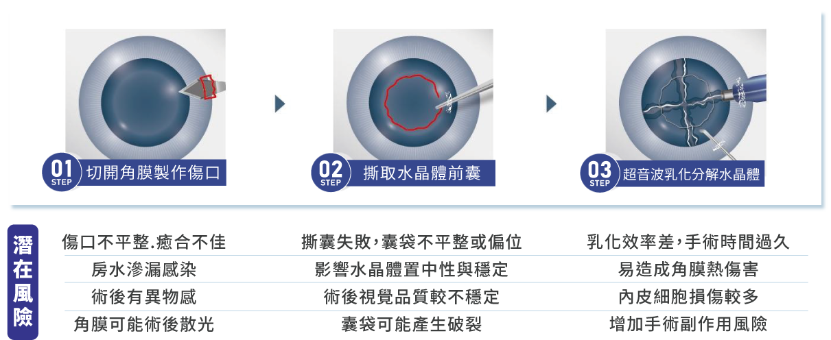 傳統白內障手術